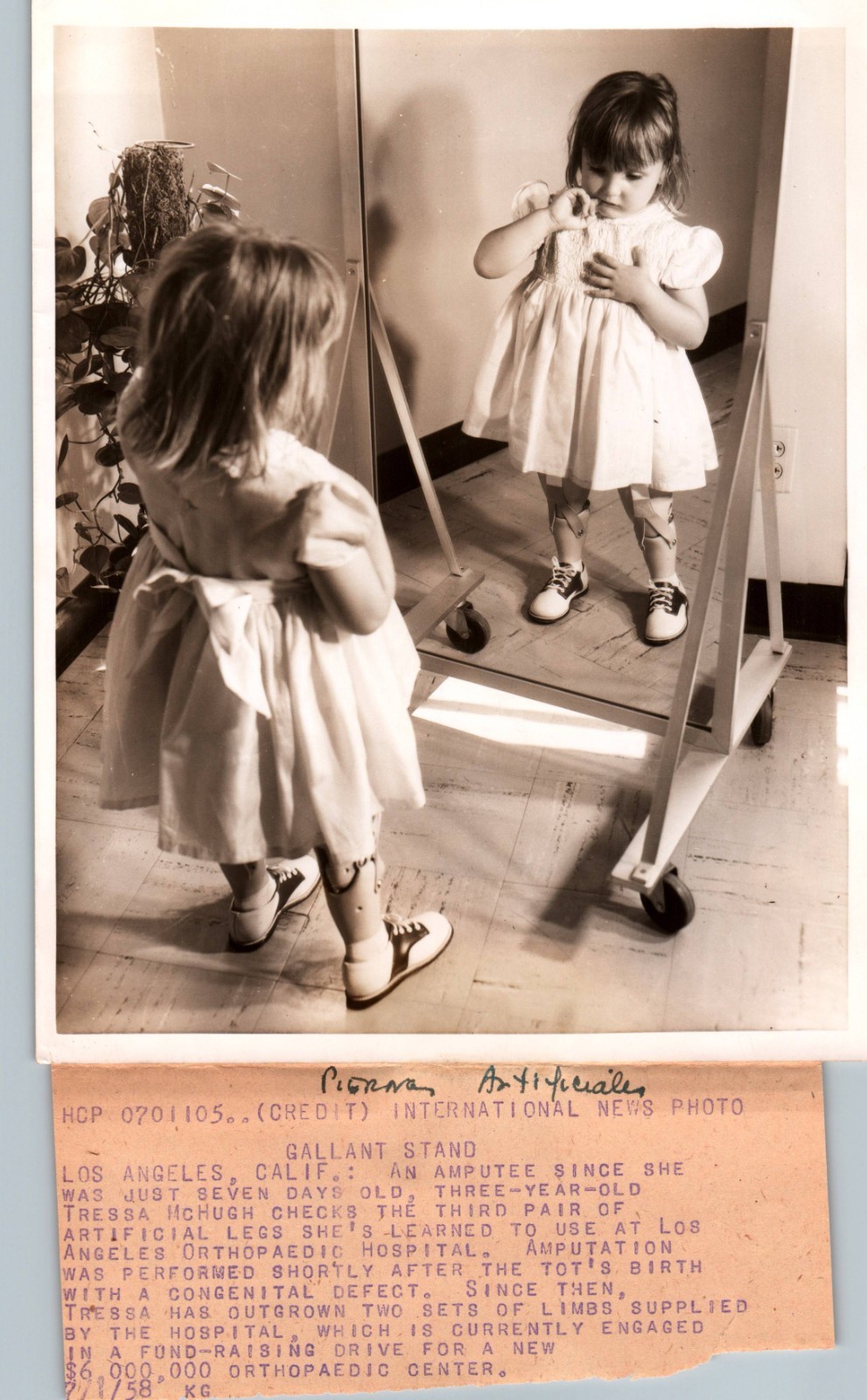 Girl with artificial legs (1958) ❤️ Vintage Collectable Press Photo 1062K