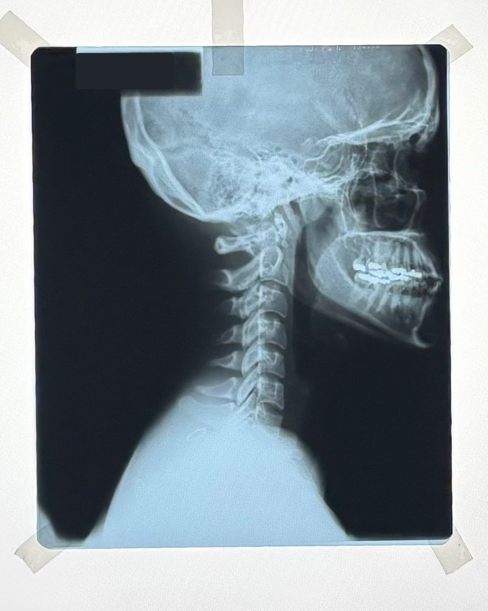 Vintage Authentic Xray Image, 10