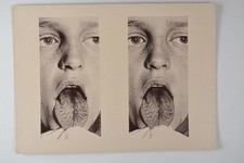 Stereoscopic Medical Atlas Faltenzunge Lingua Plicata Breslau 1896 VTG Photo picture